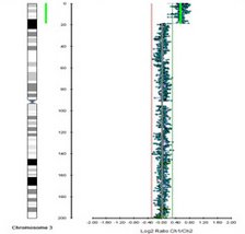 Array-CGH-Diagnostik, Mikroduplikation aus Chromosom 3 