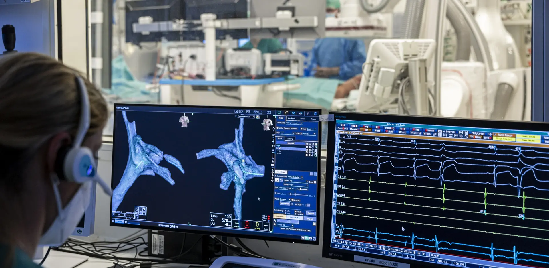 Elektrophysiologie, Kinderherzkatheter